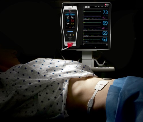 Masimo Patient SafetyNet<sup>™</sup>