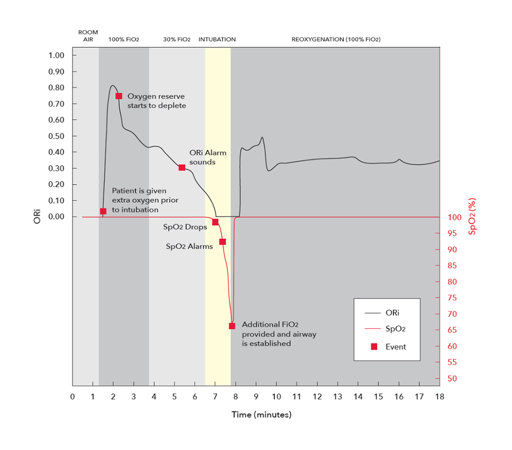 ORi During Orotrachel Intubation Graph