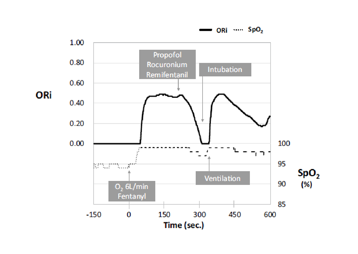 ORi During RSI Graph