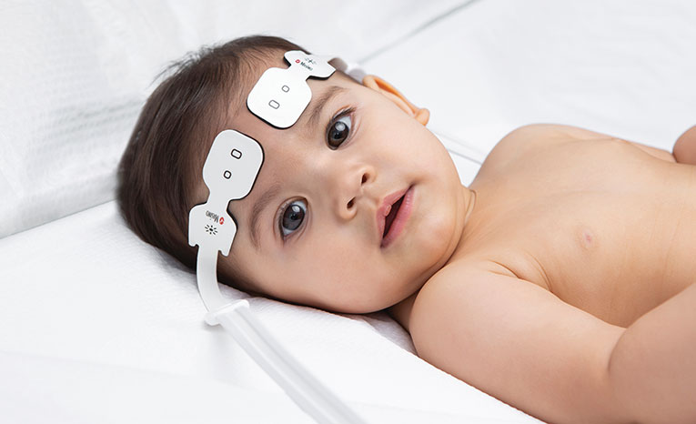 Masimo - Baby with O3 Regional Oximetry sensor on forehead
