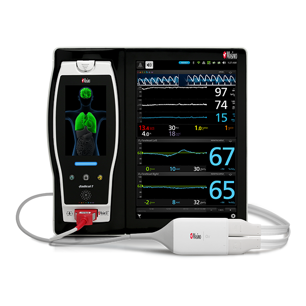 Root® with O3® Regional Oximetry