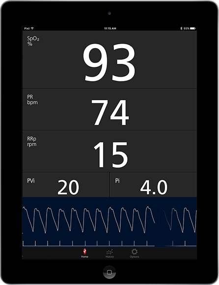 Masimo - Measurements shown on Masimo Professional Health App