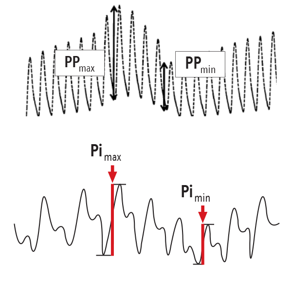Masimo - PVi chart of dynamic parameters