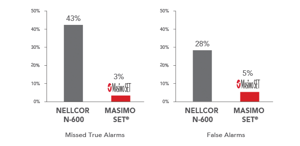Masimo - Alarm Reliability with Signal Extraction Performance During Motion and Low Perfusion